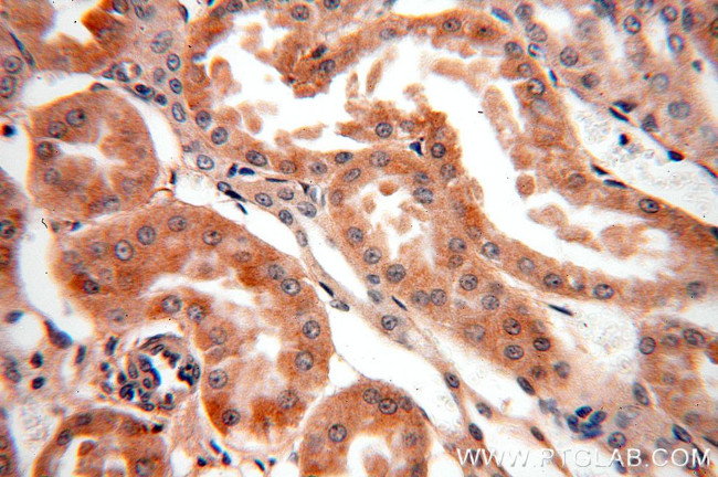 GABARAPL1 Antibody in Immunohistochemistry (Paraffin) (IHC (P))