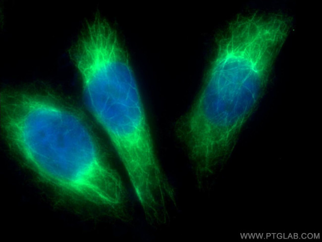 iNOS Antibody in Immunocytochemistry (ICC/IF)