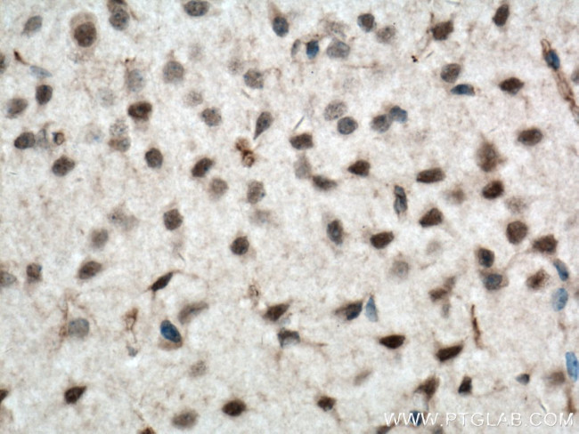 iNOS Antibody in Immunohistochemistry (Paraffin) (IHC (P))