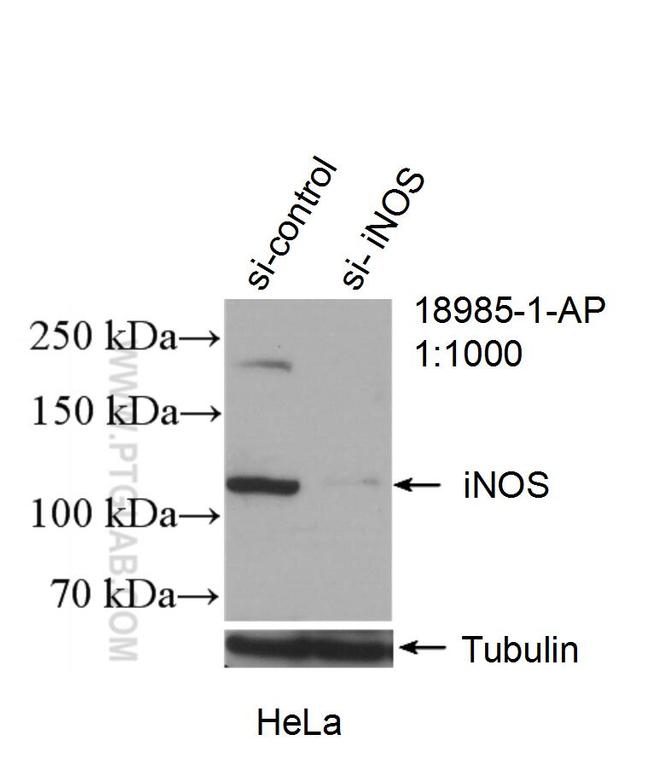 iNOS Antibody in Western Blot (WB)