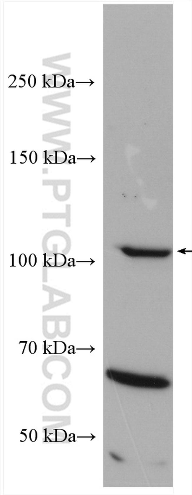 iNOS Antibody in Western Blot (WB)