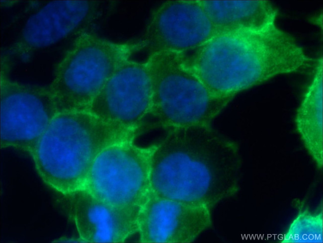 EGFR Antibody in Immunocytochemistry (ICC/IF)