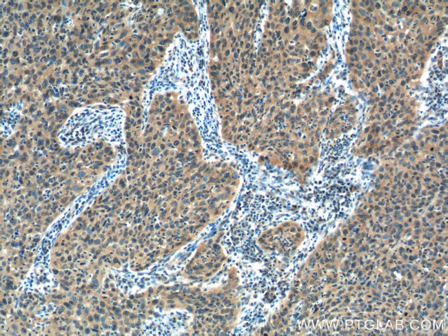 EGFR Antibody in Immunohistochemistry (Paraffin) (IHC (P))