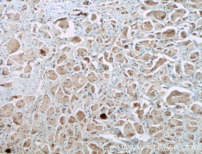 EGFR Antibody in Immunohistochemistry (Paraffin) (IHC (P))