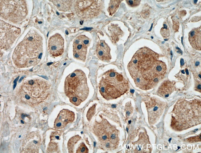 EGFR Antibody in Immunohistochemistry (Paraffin) (IHC (P))