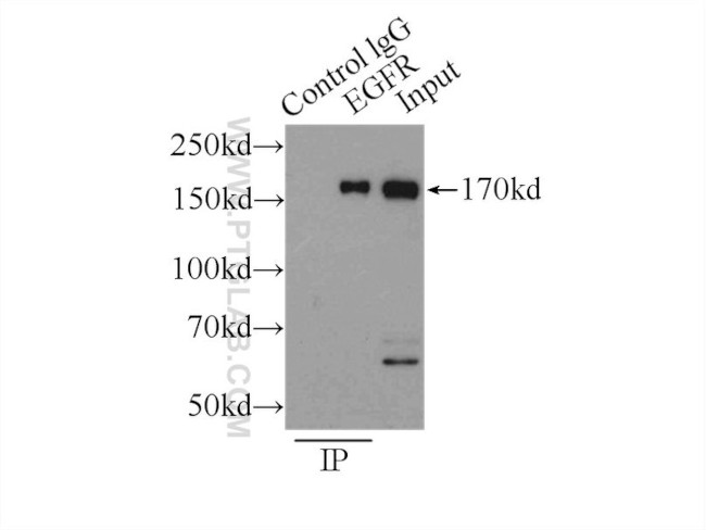 EGFR Antibody in Immunoprecipitation (IP)