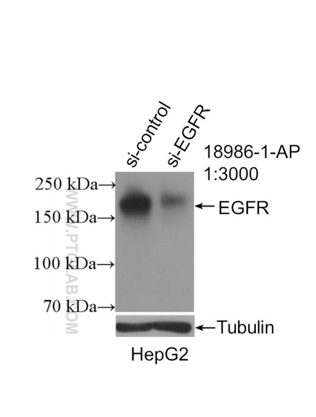 EGFR Antibody in Western Blot (WB)