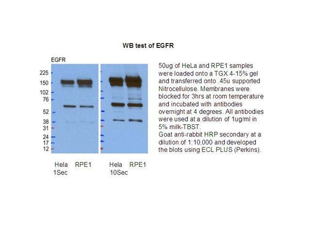 EGFR Antibody in Western Blot (WB)