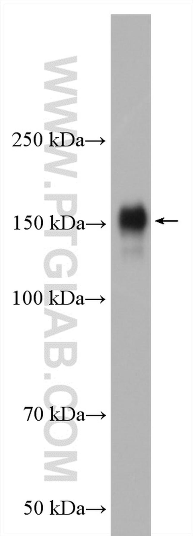 EGFR Antibody in Western Blot (WB)