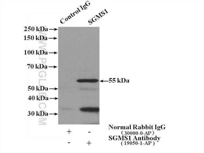 SGMS1 Antibody in Immunoprecipitation (IP)