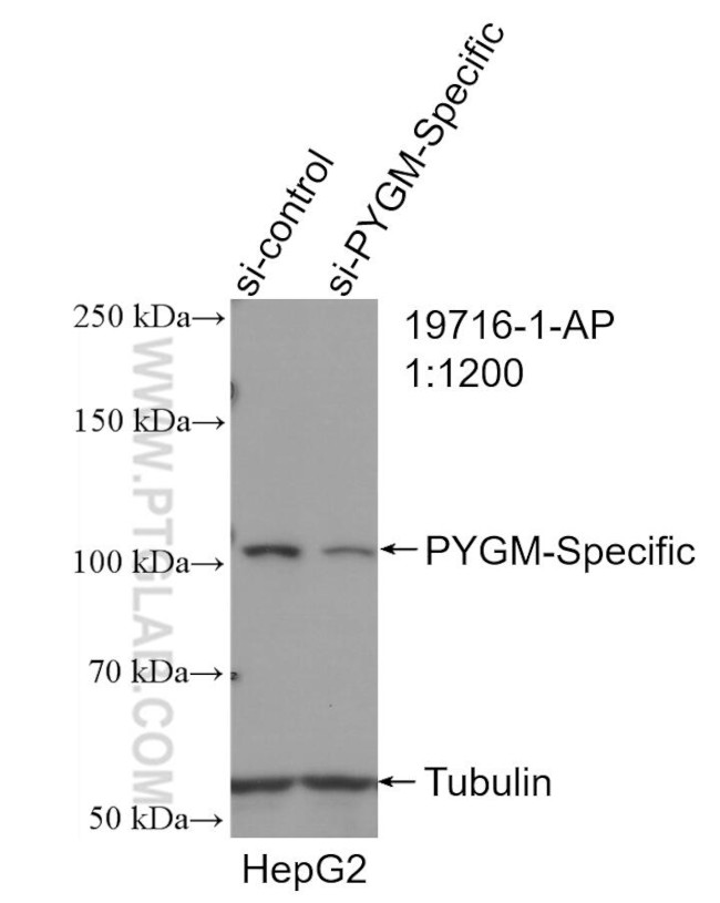 PYGM Antibody in Western Blot (WB)