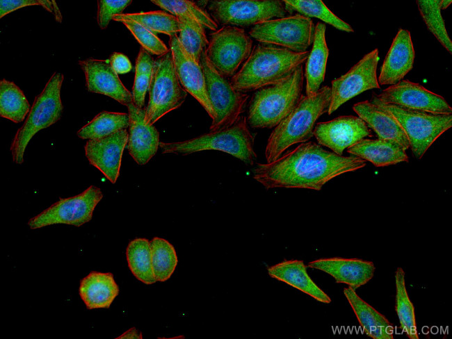 NLRP3 Antibody in Immunocytochemistry (ICC/IF)