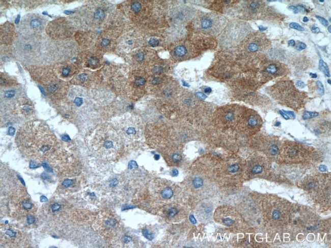 hIST1 Antibody in Immunohistochemistry (Paraffin) (IHC (P))