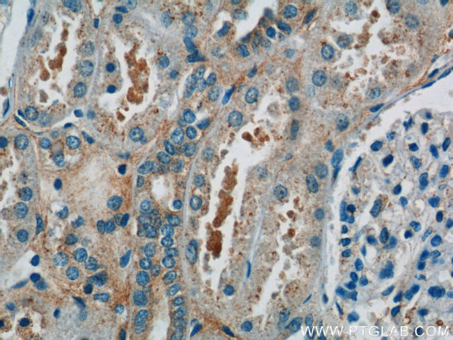 hIST1 Antibody in Immunohistochemistry (Paraffin) (IHC (P))