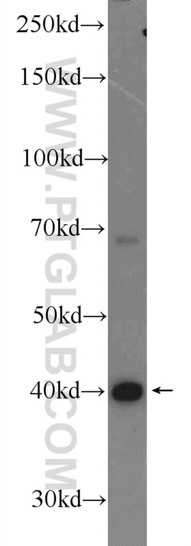 hIST1 Antibody in Western Blot (WB)