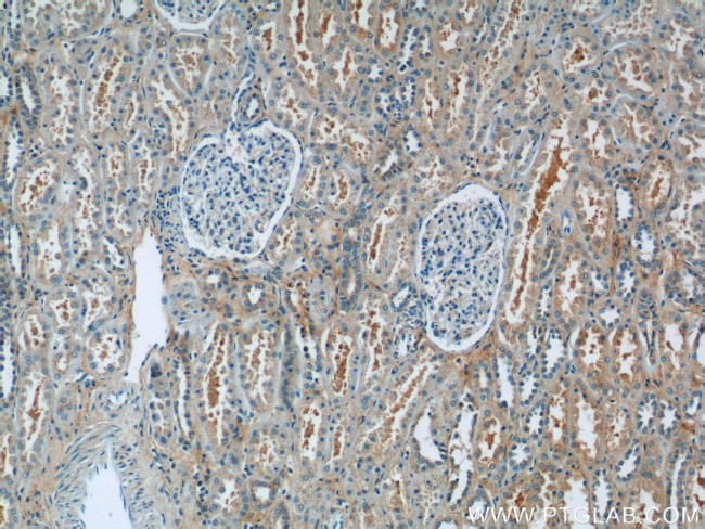 hIST1 Antibody in Immunohistochemistry (Paraffin) (IHC (P))