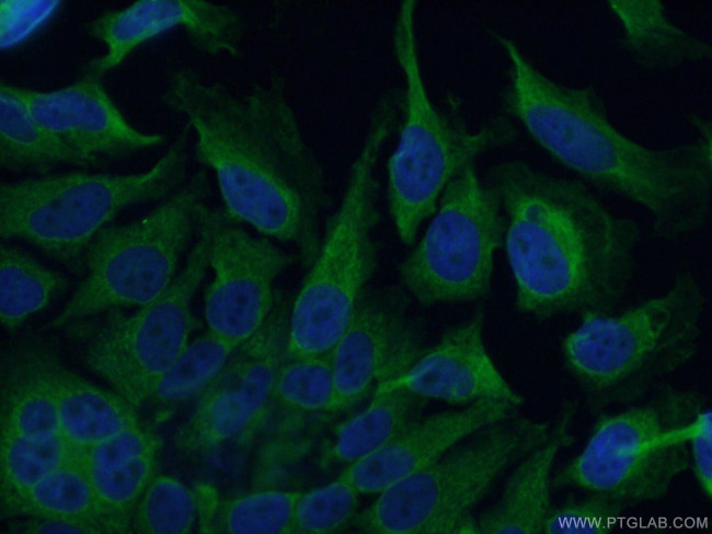 CYP2E1 Antibody in Immunocytochemistry (ICC/IF)