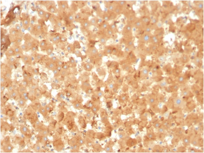 Alpha-2-Macroglobulin Antibody in Immunohistochemistry (Paraffin) (IHC (P))