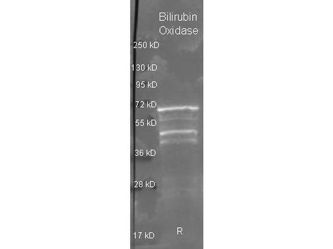 Bilirubin Oxidase Antibody in Western Blot (WB)