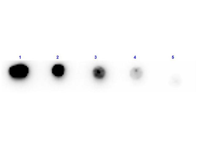 Trypsin Inhibitor Antibody in Dot Blot (DB)