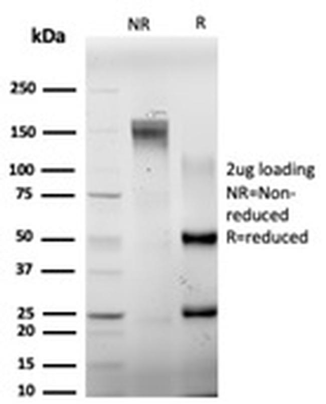 ELK1 Antibody in SDS-PAGE (SDS-PAGE)