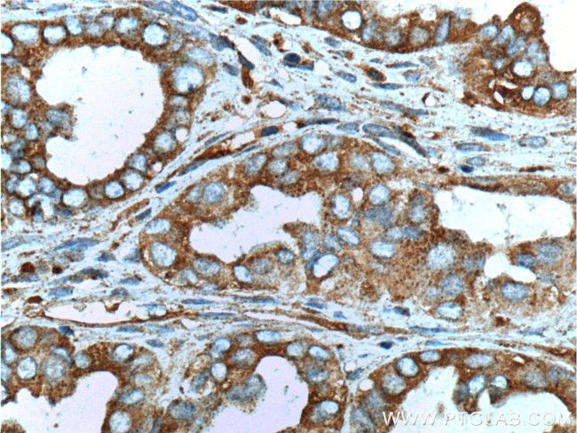 MUC16/CA125 Antibody in Immunohistochemistry (Paraffin) (IHC (P))