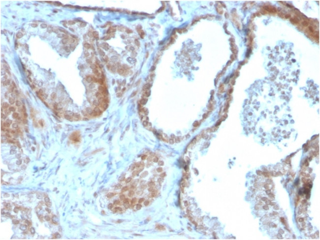 TIGIT/VSTM3/VSIG9 (Immune Checkpoint for Cancer) Antibody in Immunohistochemistry (Paraffin) (IHC (P))