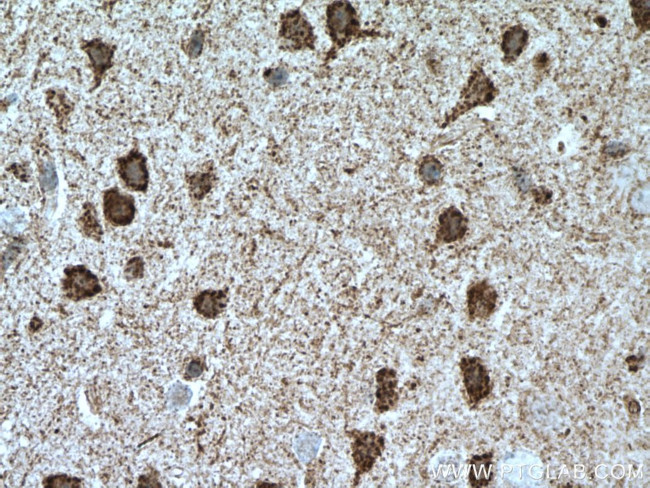 UNC5C Antibody in Immunohistochemistry (Paraffin) (IHC (P))