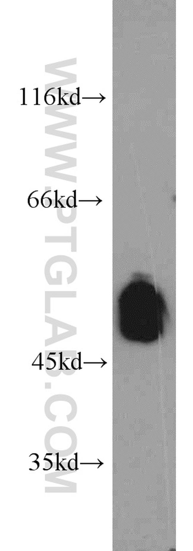 UNC5C Antibody in Western Blot (WB)