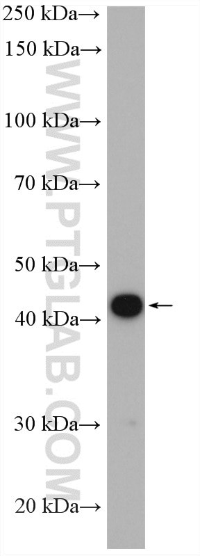 NPHS2 Antibody in Western Blot (WB)