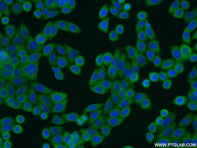 EPS8L2 Antibody in Immunocytochemistry (ICC/IF)