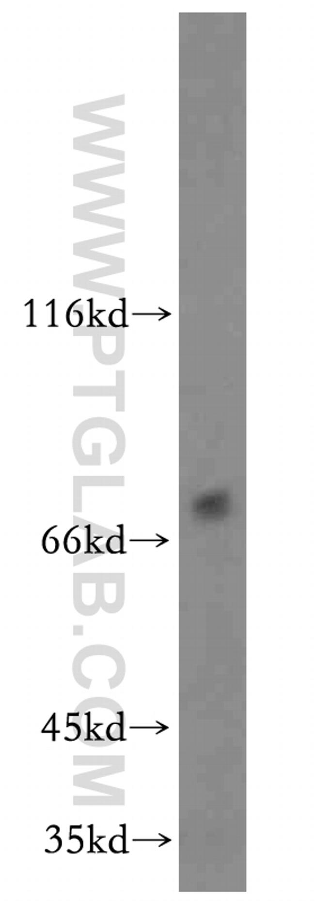 ZNF34 Antibody in Western Blot (WB)