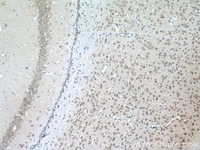 SLC11A2 Antibody in Immunohistochemistry (Paraffin) (IHC (P))