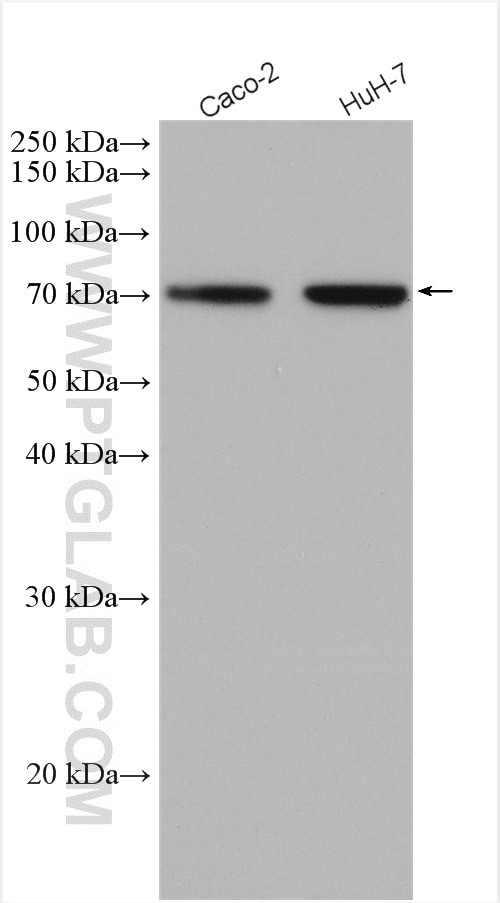 SLC11A2 Antibody in Western Blot (WB)