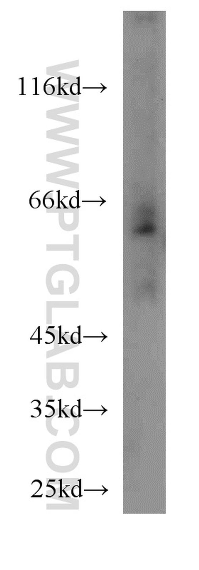 SLC11A2 Antibody in Western Blot (WB)