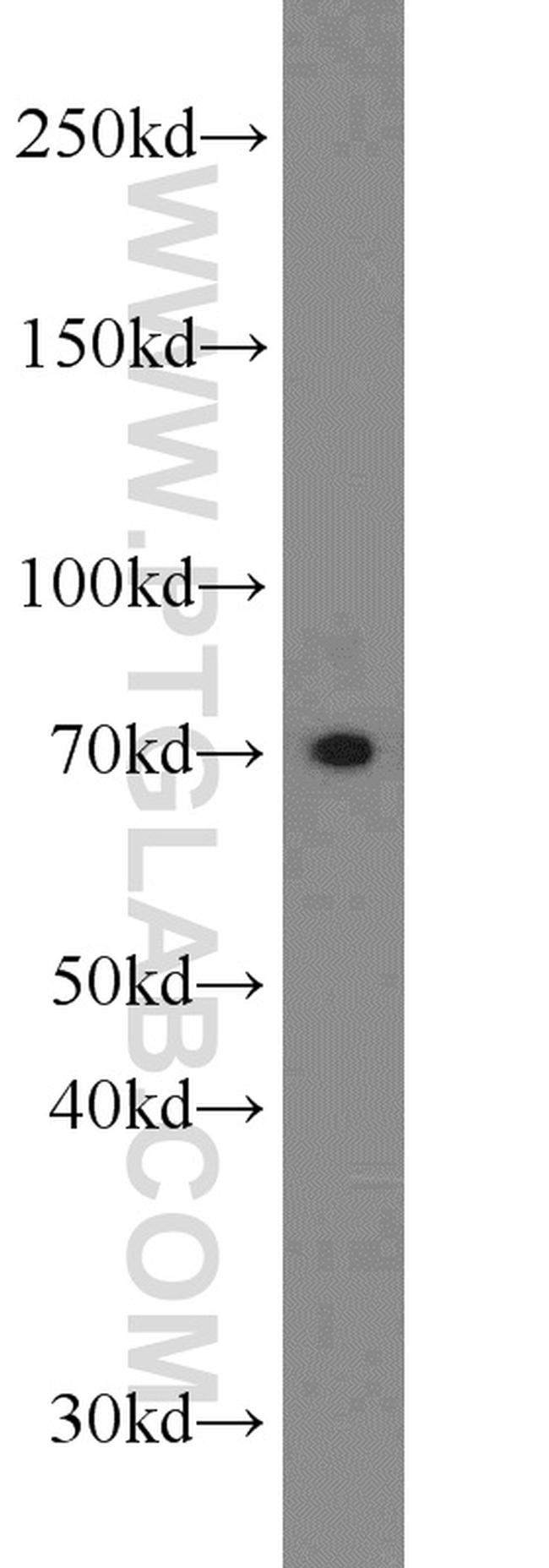 SLC11A2 Antibody in Western Blot (WB)