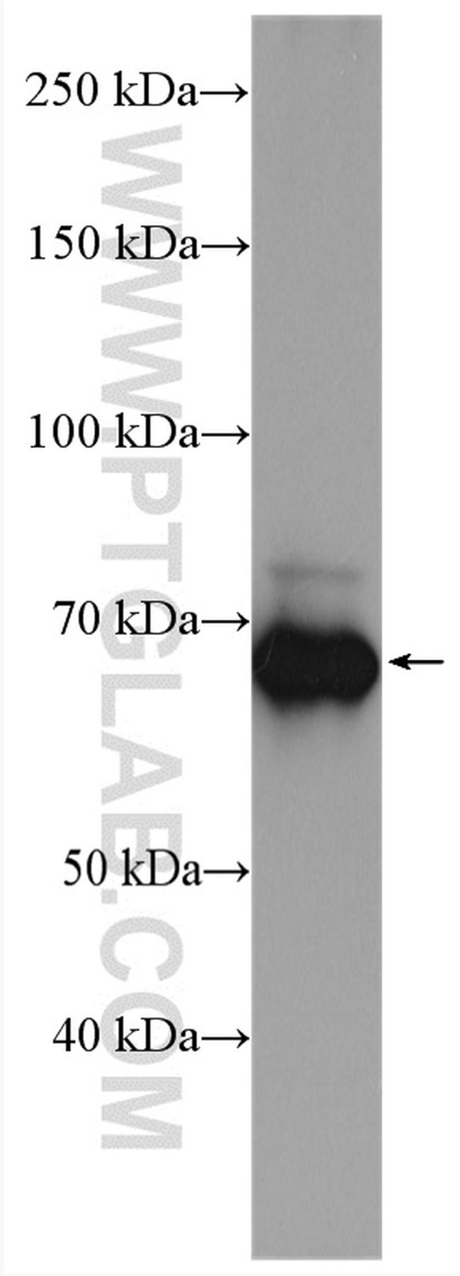 SLC11A2 Antibody in Western Blot (WB)