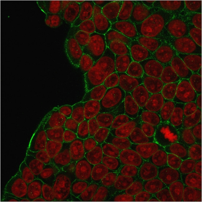 HER-2/c-erbB-2/neu/CD340 Antibody in Immunocytochemistry (ICC/IF)