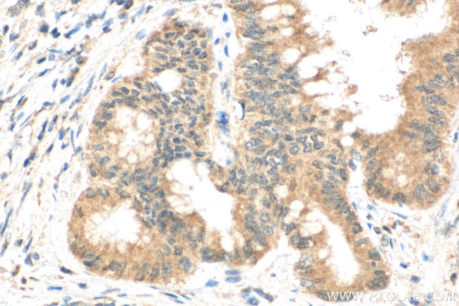 POLR2A Antibody in Immunohistochemistry (Paraffin) (IHC (P))