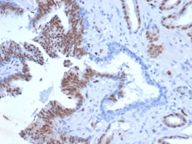 ERG (Vascular Endothelial and Prostate Marker) Antibody in Immunohistochemistry (Paraffin) (IHC (P))