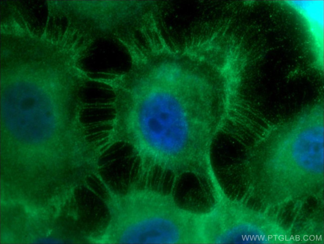 E-cadherin Antibody in Immunocytochemistry (ICC/IF)