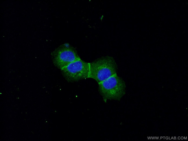 E-cadherin Antibody in Immunocytochemistry (ICC/IF)