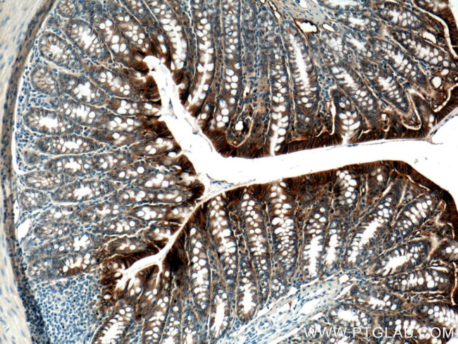 E-cadherin Antibody in Immunohistochemistry (Paraffin) (IHC (P))