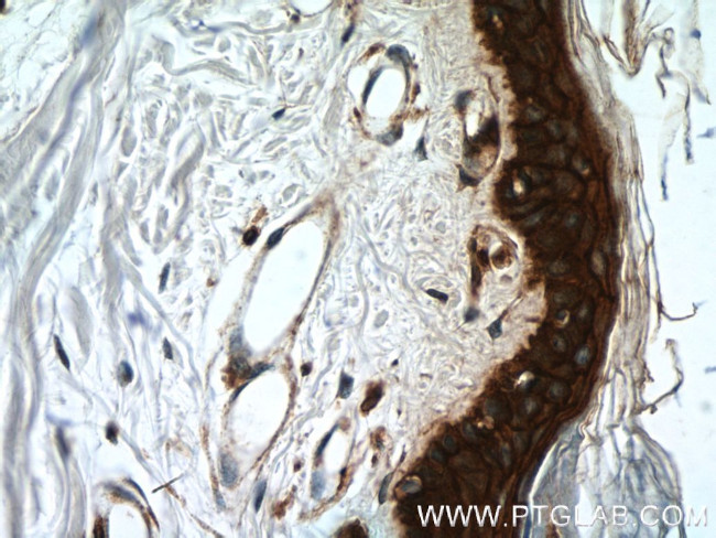 E-cadherin Antibody in Immunohistochemistry (Paraffin) (IHC (P))