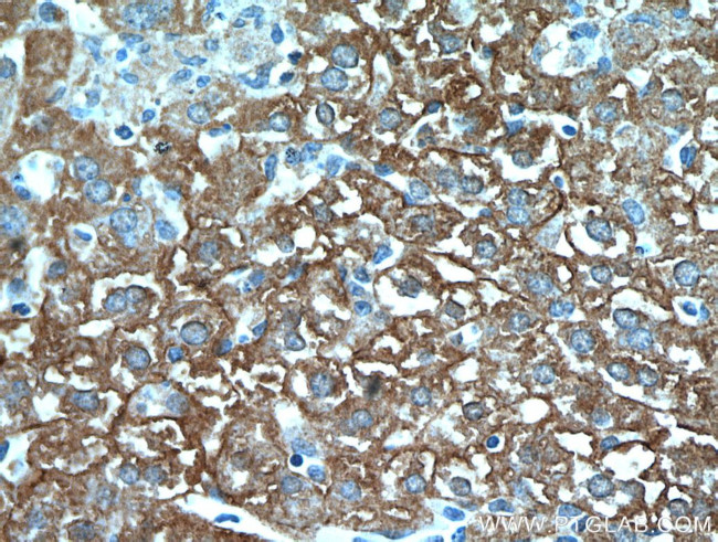 E-cadherin Antibody in Immunohistochemistry (Paraffin) (IHC (P))