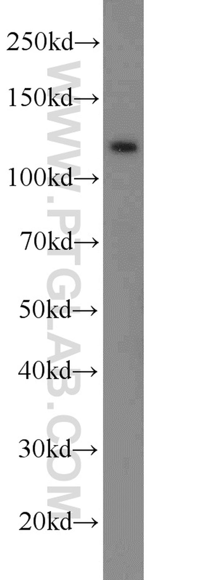 E-cadherin Antibody in Western Blot (WB)