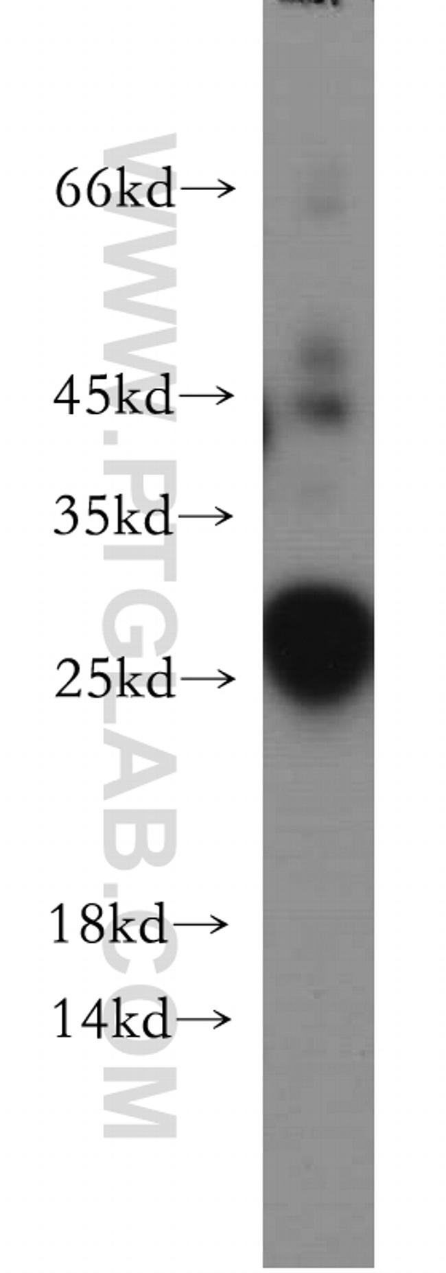 DPCD Antibody in Western Blot (WB)
