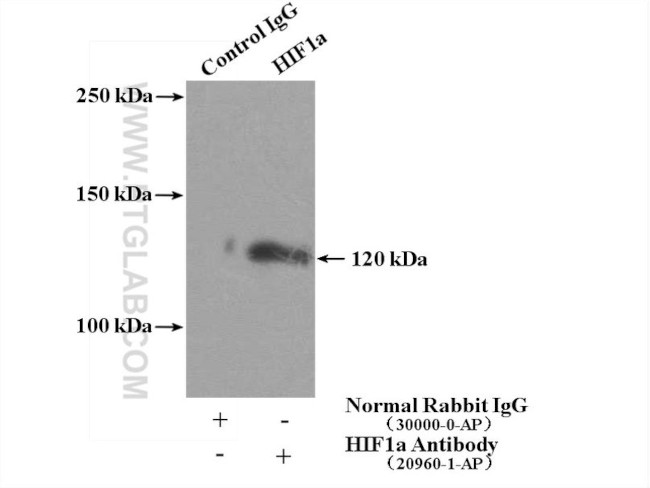 HIF1a Antibody in Immunoprecipitation (IP)