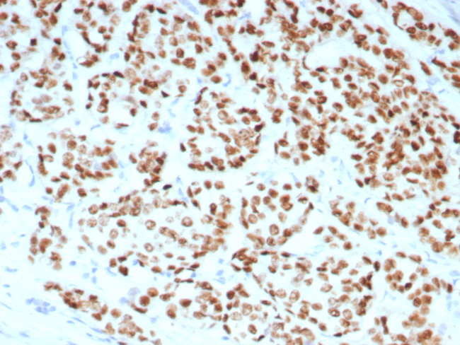 Estrogen Receptor, alpha (Marker of Estrogen Dependence) Antibody in Immunohistochemistry (Paraffin) (IHC (P))