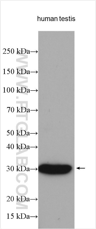 ANKRD7 Antibody in Western Blot (WB)